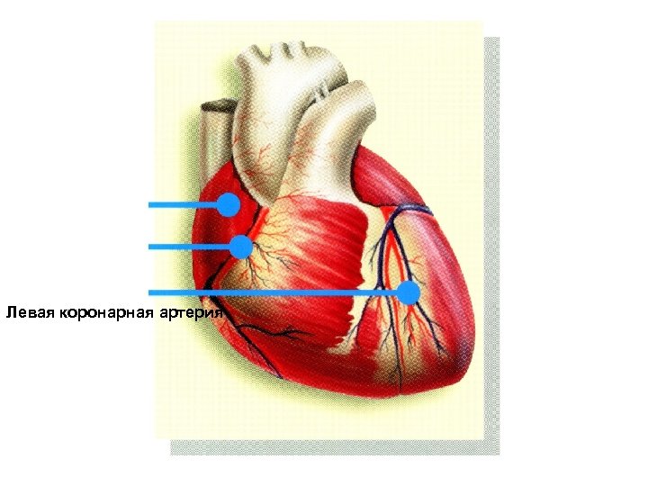 Левая коронарная артерия 
