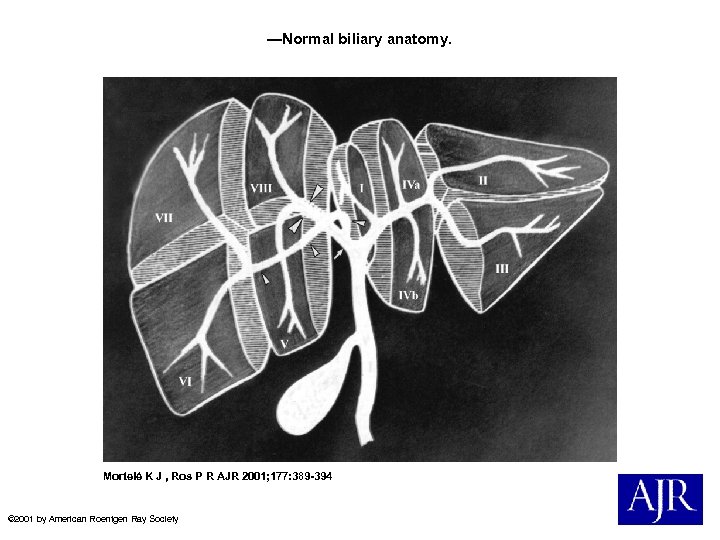 —Normal biliary anatomy. Mortelé K J , Ros P R AJR 2001; 177: 389