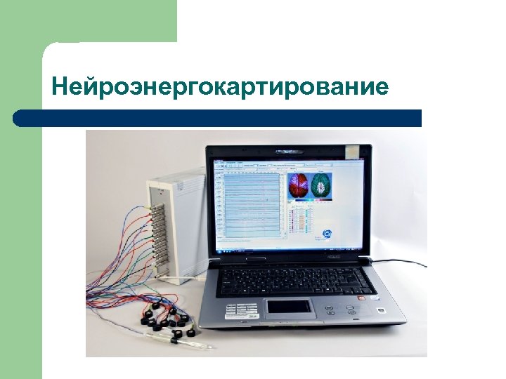 Нейроэнергокартирование 