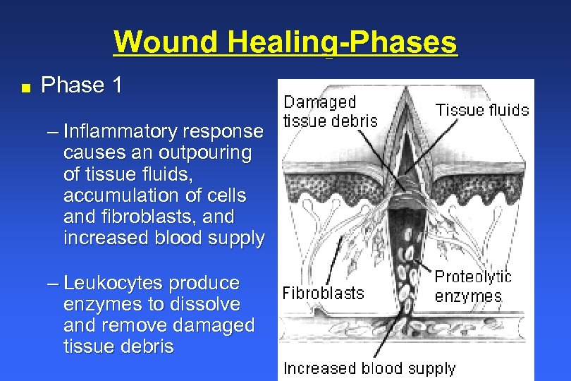 Wound Healing-Phases n Phase 1 – Inflammatory response causes an outpouring of tissue fluids,