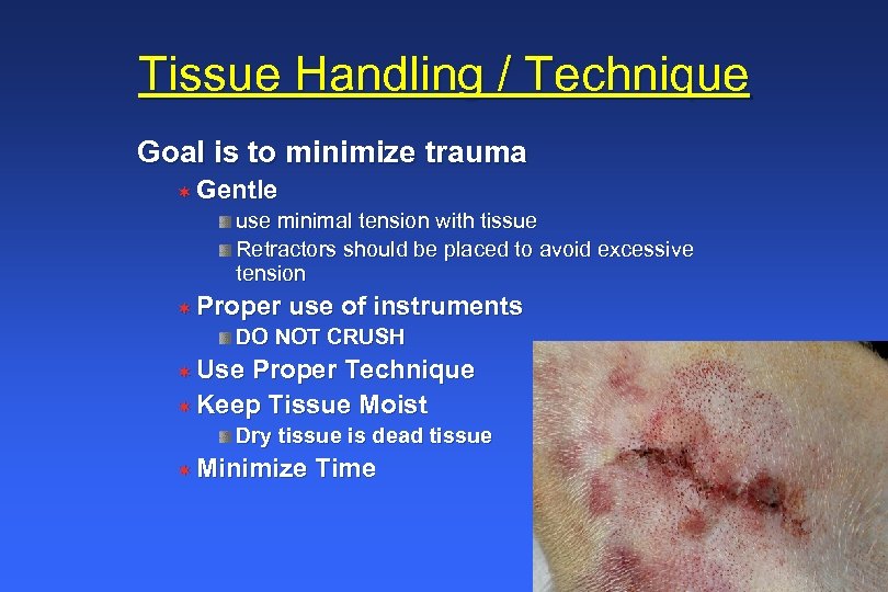 Tissue Handling / Technique Goal is to minimize trauma ¬ Gentle use minimal tension