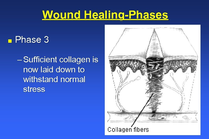 Wound Healing-Phases n Phase 3 – Sufficient collagen is now laid down to withstand