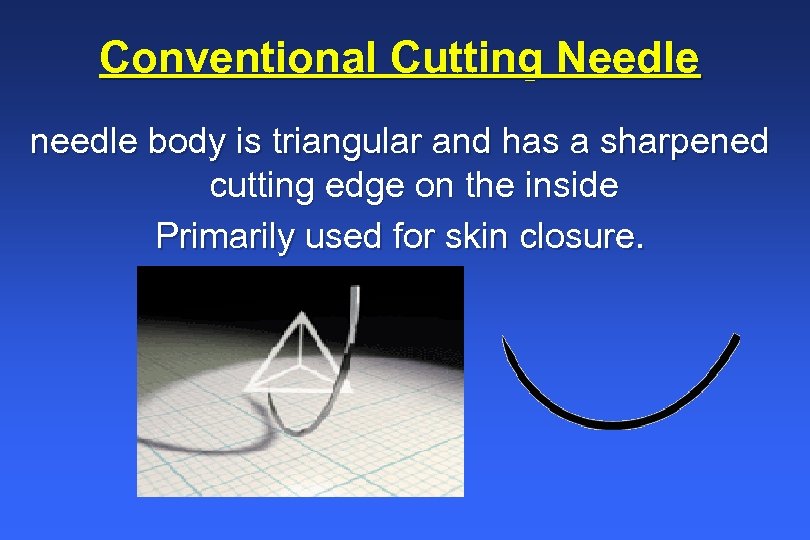 Conventional Cutting Needle needle body is triangular and has a sharpened cutting edge on