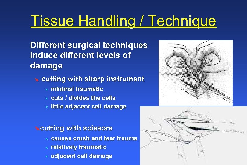 Tissue Handling / Technique Different surgical techniques induce different levels of damage Ø cutting