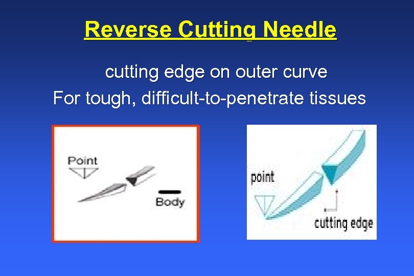 Reverse Cutting Needle cutting edge on outer curve For tough, difficult-to-penetrate tissues 