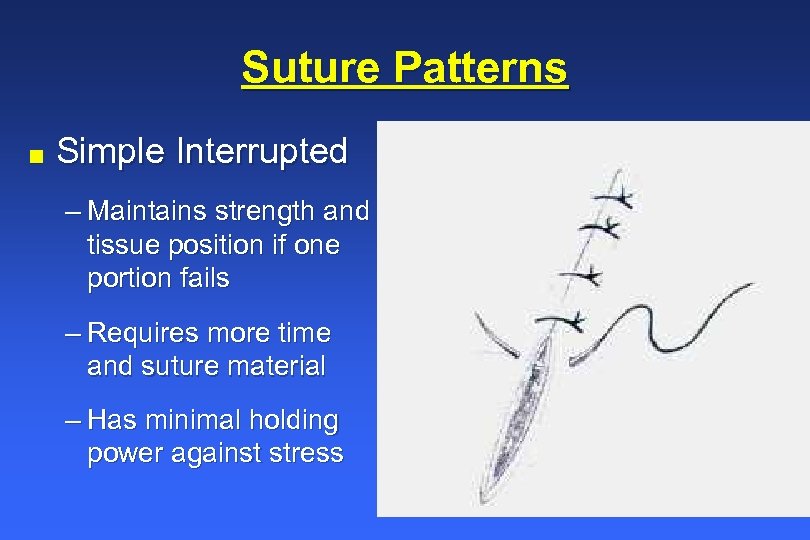 Suture Patterns n Simple Interrupted – Maintains strength and tissue position if one portion