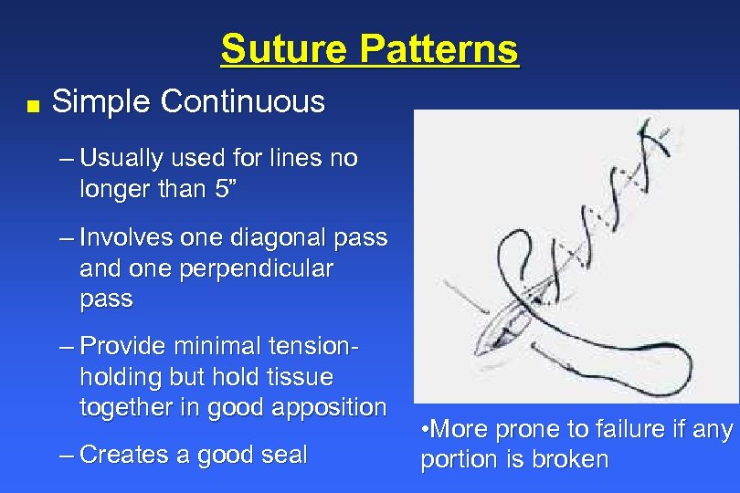 Suture Patterns n Simple Continuous – Usually used for lines no longer than 5”