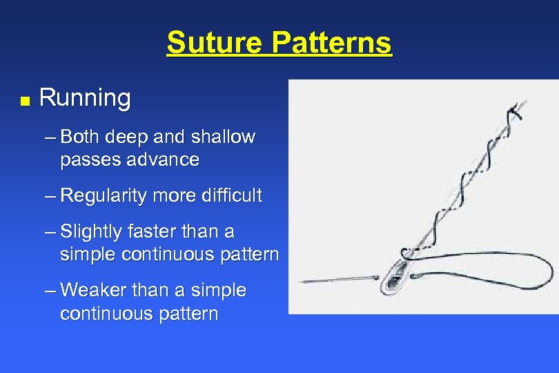 Suture Patterns n Running – Both deep and shallow passes advance – Regularity more