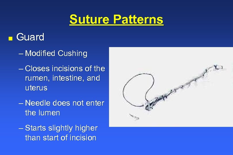 Suture Patterns n Guard – Modified Cushing – Closes incisions of the rumen, intestine,