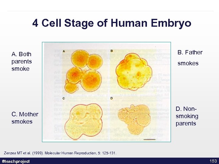 4 Cell Stage of Human Embryo A. Both parents smoke C. Mother smokes B.