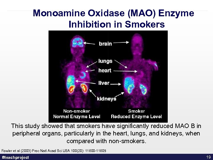 Monoamine Oxidase (MAO) Enzyme Inhibition in Smokers This study showed that smokers have significantly