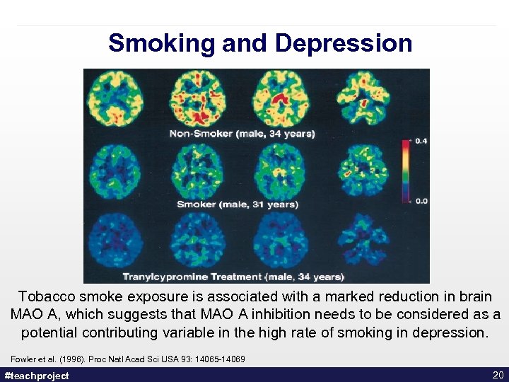 Smoking and Depression Tobacco smoke exposure is associated with a marked reduction in brain