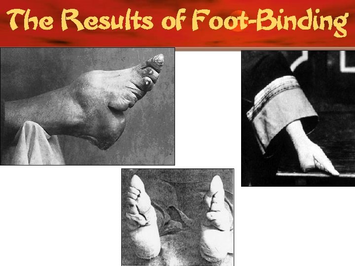 The Results of Foot-Binding 
