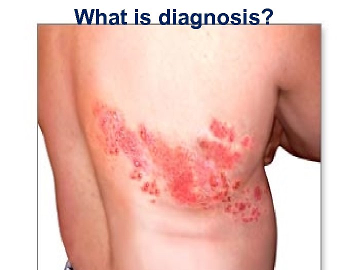 What is diagnosis? 