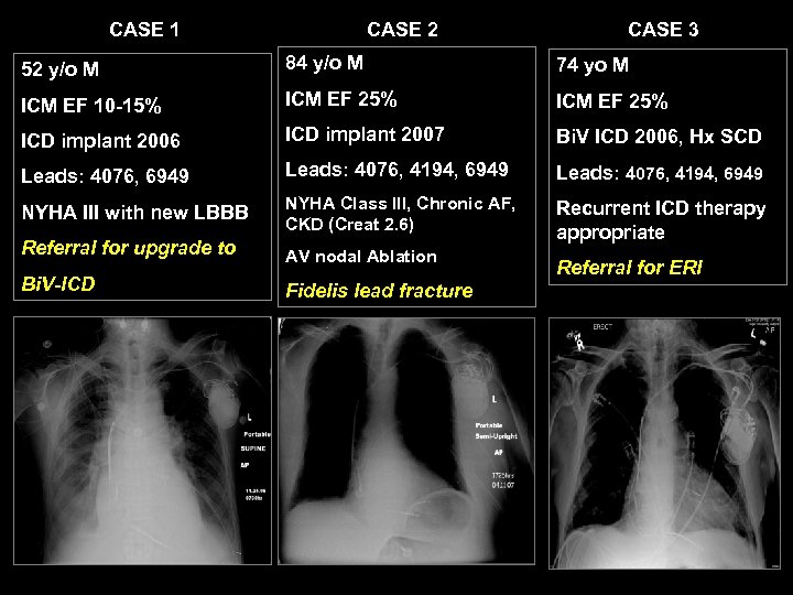 CASE 1 CASE 2 CASE 3 52 y/o M 84 y/o M 74 yo