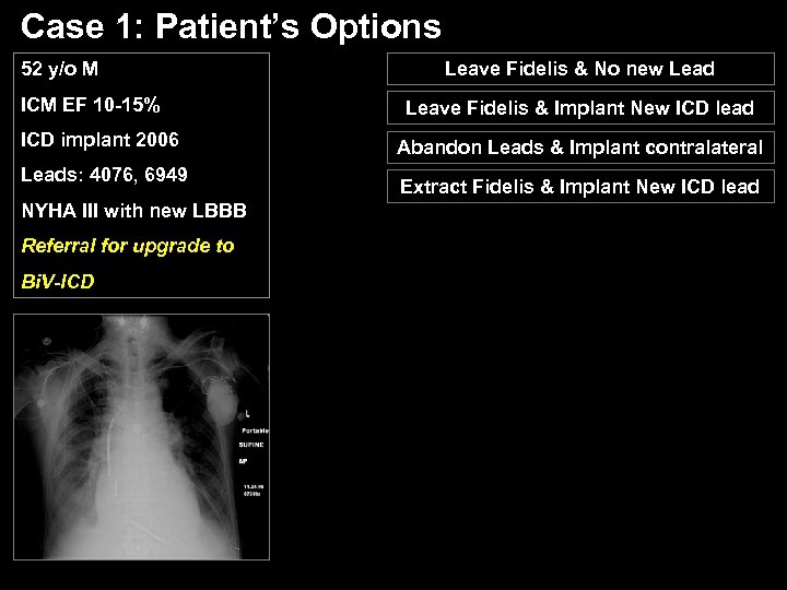 Case 1: Patient’s Options 52 y/o M ICM EF 10 -15% ICD implant 2006