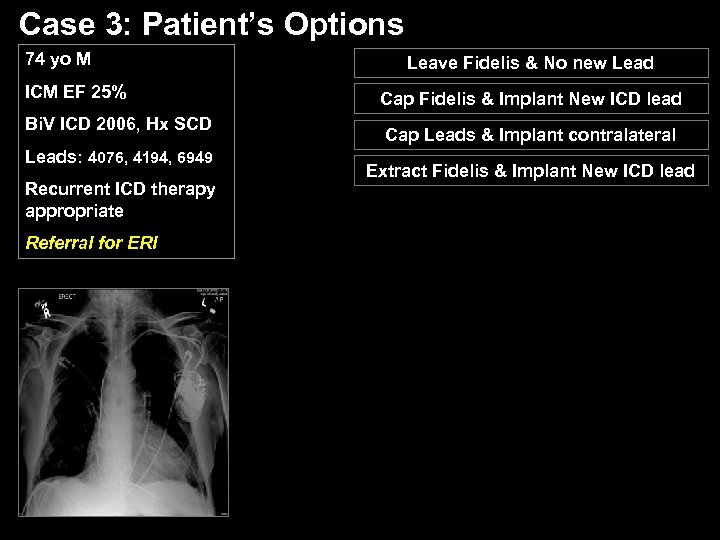 Case 3: Patient’s Options 74 yo M ICM EF 25% Bi. V ICD 2006,