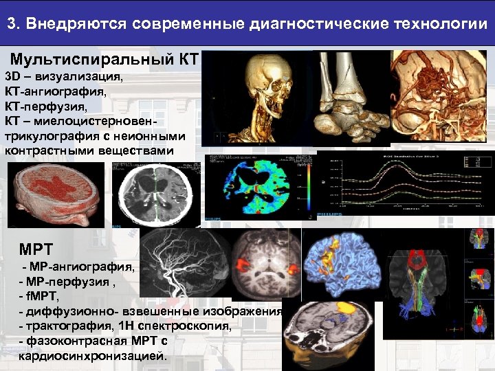 3. Внедряются современные диагностические технологии Мультиспиральный КТ 3 D – визуализация, КТ-ангиография, КТ-перфузия, КТ