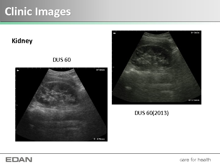 Clinic Images Kidney DUS 60(2013) care for health 