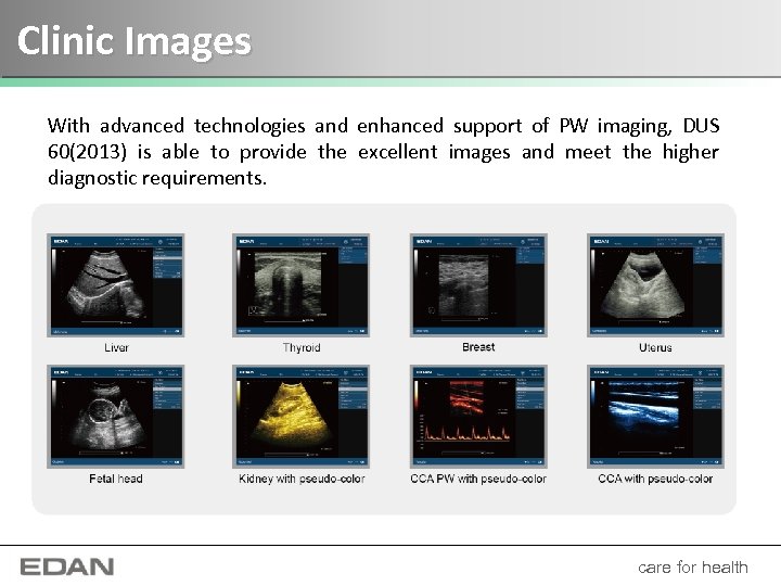 Clinic Images With advanced technologies and enhanced support of PW imaging, DUS 60(2013) is