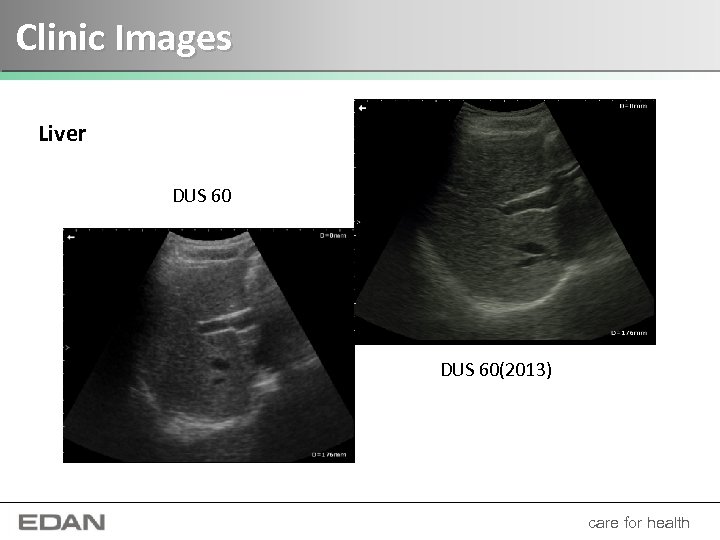 Clinic Images Liver DUS 60(2013) care for health 