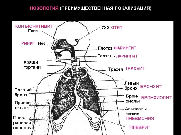 НОЗОЛОГИЯ (ПРЕИМУЩЕСТВЕННАЯ ЛОКАЛИЗАЦИЯ) 