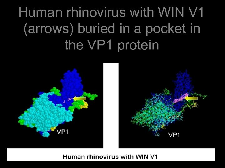 Human rhinovirus with WIN V 1 (arrows) buried in a pocket in the VP