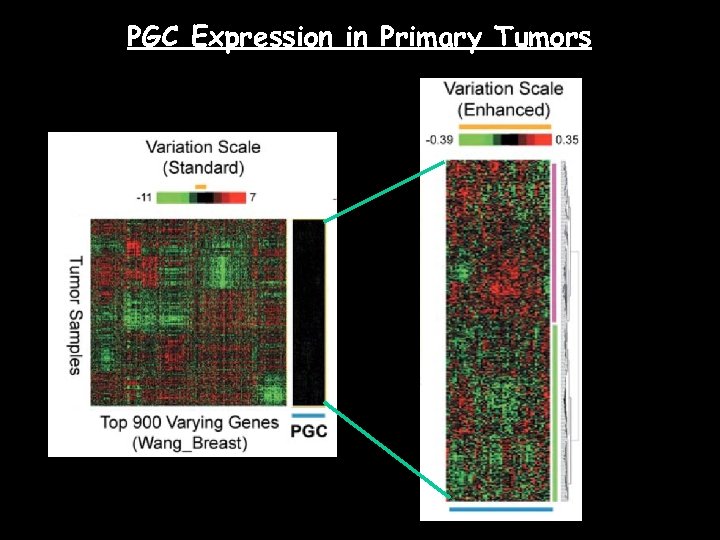 PGC Expression in Primary Tumors 