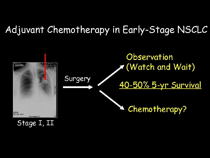 Adjuvant Chemotherapy in Early-Stage NSCLC Observation (Watch and Wait) Surgery 40 -50% 5 -yr