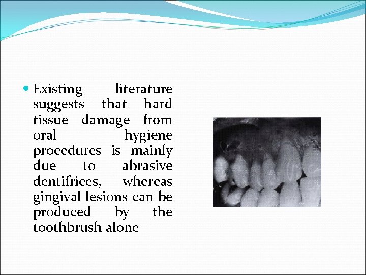  Existing literature suggests that hard tissue damage from oral hygiene procedures is mainly
