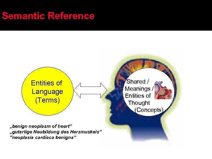 Semantic Reference Entities of Language (Terms) „benign neoplasm of heart“ „gutartige Neubildung des Herzmuskels”