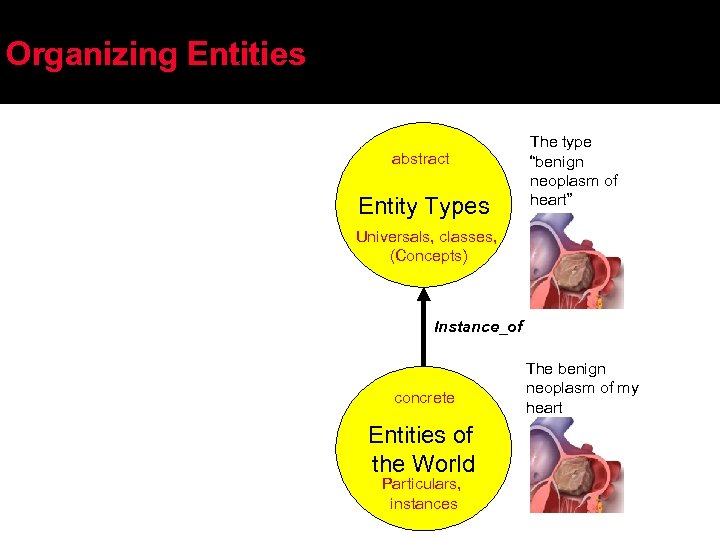 Organizing Entities abstract Entity Types The type “benign neoplasm of heart” Universals, classes, (Concepts)