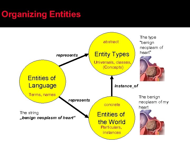 Organizing Entities abstract represents Entity Types The type “benign neoplasm of heart” Universals, classes,