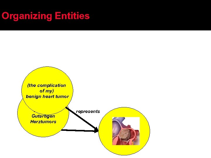 Organizing Entities (the complication of my) benign heart tumor (die Komplikation meines) Gutartigen Herztumors