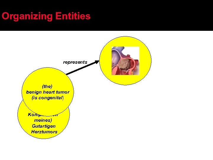 Organizing Entities represents (the) benign heart tumor (is congenital) Terms, names (die Komplikation meines)