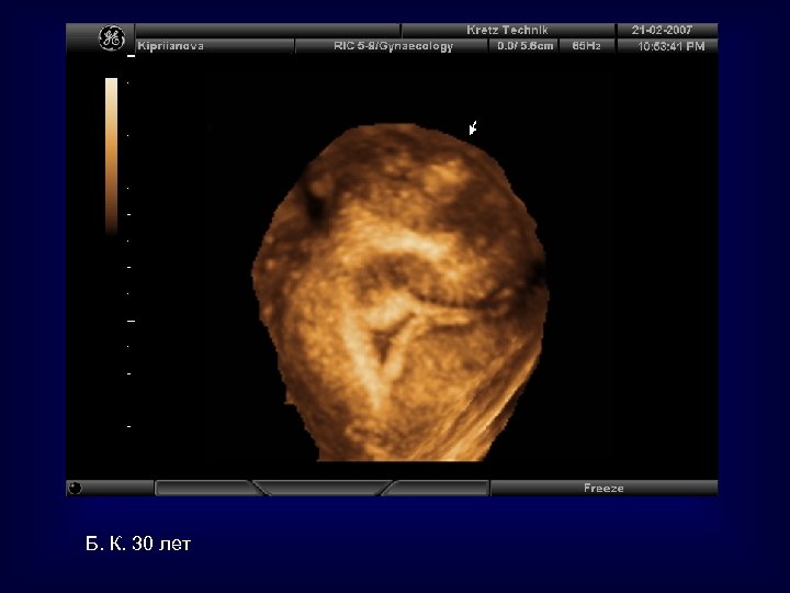 Б. К. 30 лет 