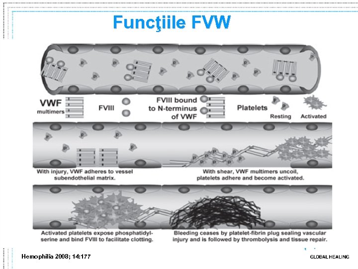 Funcţiile FVW Hemophilia 2008; 14: 177 