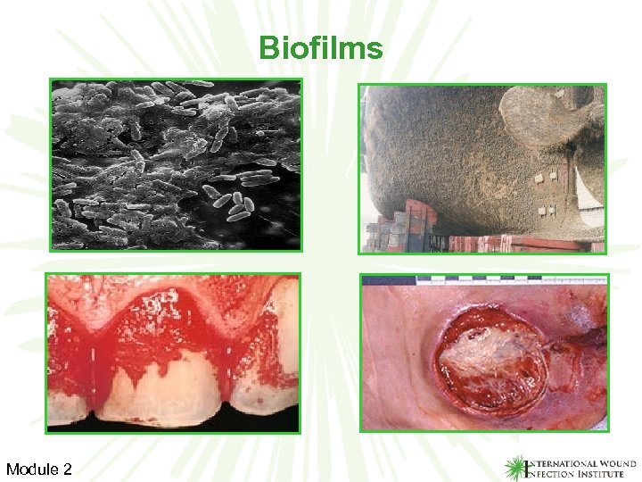 Biofilms Module 2 