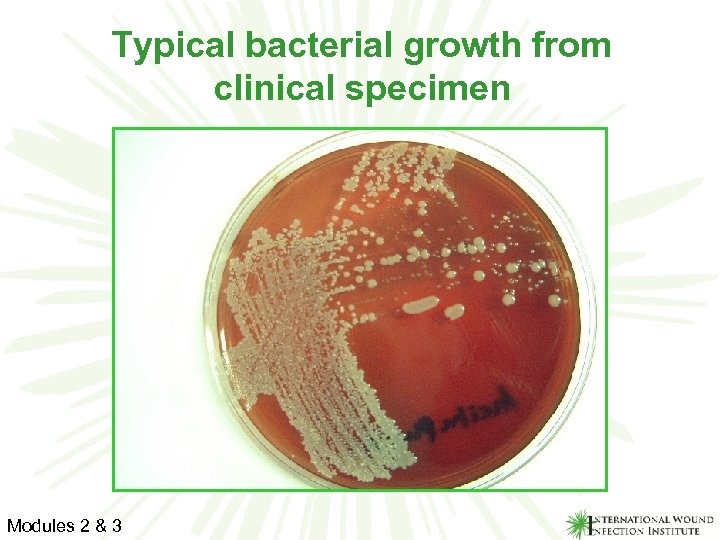 Typical bacterial growth from clinical specimen Modules 2 & 3 