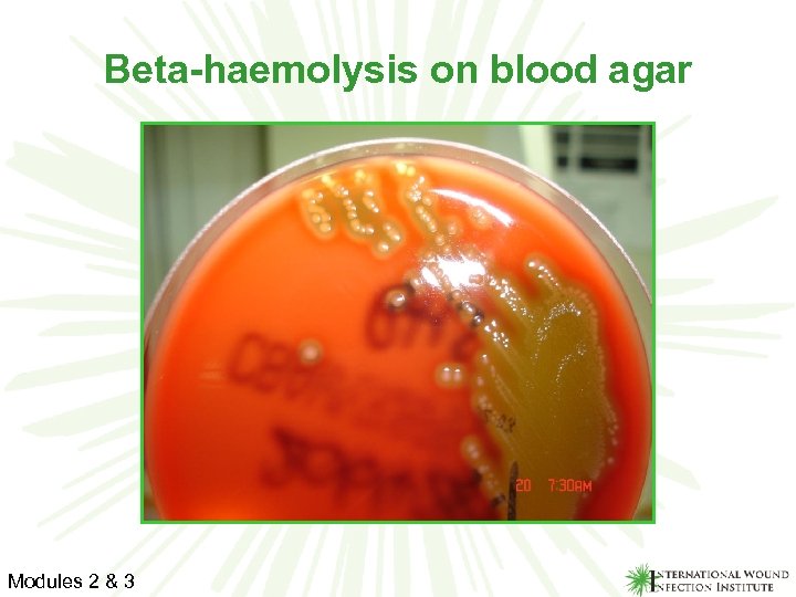 Beta-haemolysis on blood agar Modules 2 & 3 