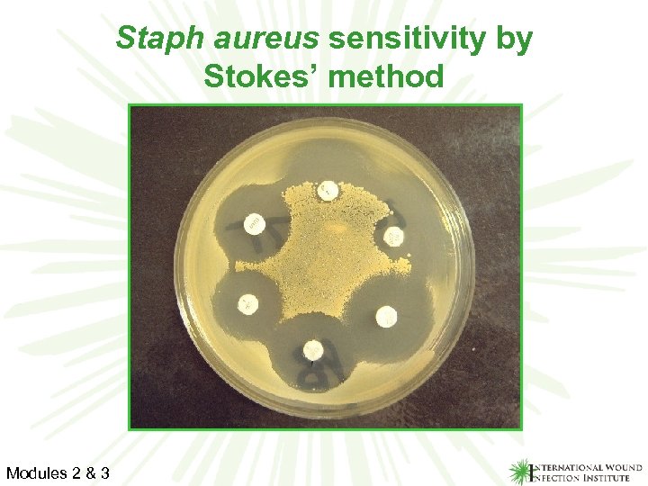 Staph aureus sensitivity by Stokes’ method Modules 2 & 3 