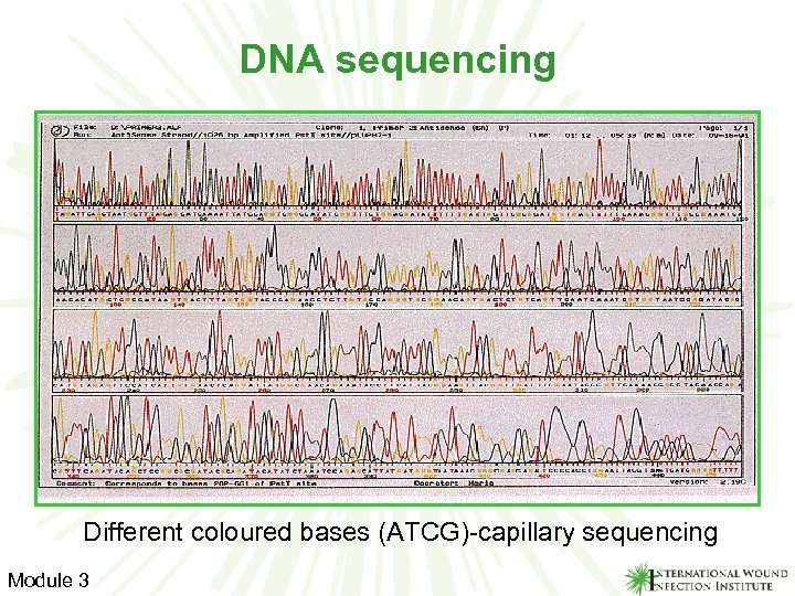 DNA sequencing Different coloured bases (ATCG)-capillary sequencing Module 3 