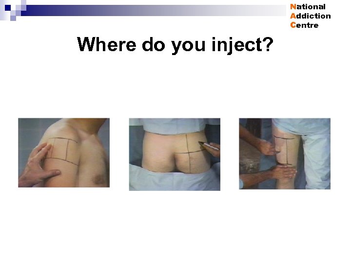 National Addiction Centre Where do you inject? 