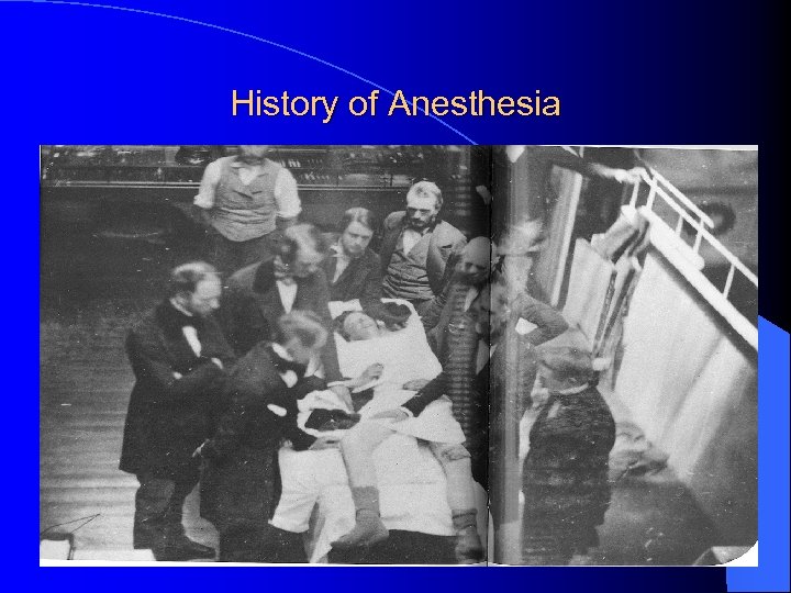 History of Anesthesia 