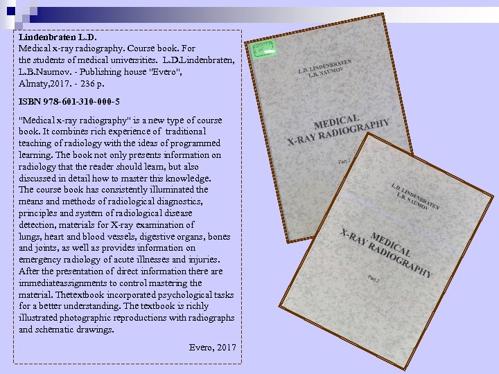 Lindenbraten L. D. Medical x ray radiography. Course book. For the students of medical