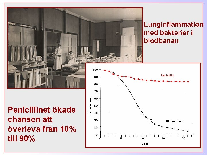 Lunginflammation med bakterier i blodbanan Penicillinet ökade chansen att överleva från 10% till 90%