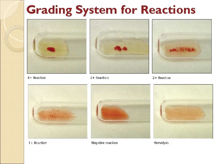 Blood Group Test Tube Method at Sheila Peters blog