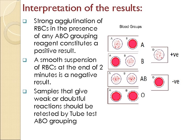 Interpretation of the results: q q q Strong agglutination of RBCs in the presence