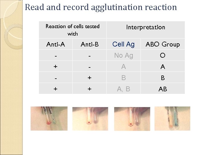 Read and record agglutination reaction Reaction of cells tested with Interpretation Anti-A Anti-B Cell