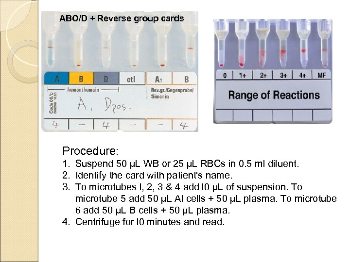 Practical Blood Bank Lab 1 ABO Grouping